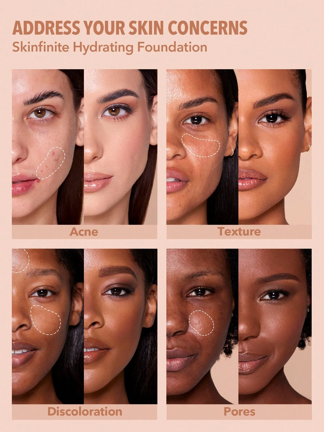 کرم پودر آبرسان شیگلم 5 کرم پودر آبرسان شیگلم - Image 5