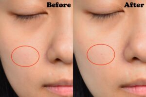 سرم ضد لک اکسیس وای AXIS-Y حجم 50 میلی لیتر 8 AXIS Y Advanced Aqua Boosting Ampoule Before and After