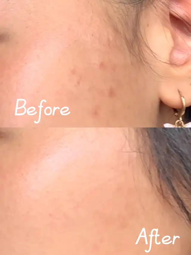 سرم ضد لک اکسیس وای AXIS-Y حجم 50 میلی لیتر 2 سرم ضد لک اکسیس وای AXIS-Y حجم 50 میلی لیتر - Image 2