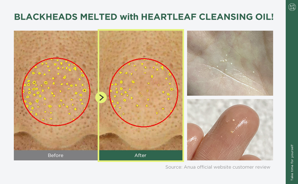 روغن پاک کننده و کنترل منافذ آنوا حاوی عصاره هوتونیا کوردتا 12 6279e5fb bccf 4054 9f0f c1fd5b18c820. CR00970600 PT0 SX970 V1