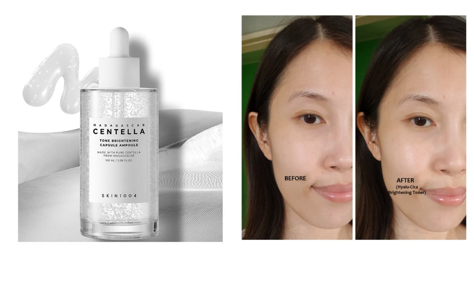 آمپول روشن کننده ماداگاسکار سنتلا تون اسکین 1004 SKIN 2 آمپول روشن کننده ماداگاسکار سنتلا تون اسکین 1004 SKIN - Image 2