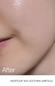 آمپول تسکین دهنده و مرطوب کننده آنوا حاوی عصاره هوتونیا کوردتا 30ml 9 AnuaUS Heartleaf 80 Soothing Ampoule 862x1341 After Listing
