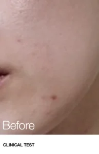 آمپول تسکین دهنده و مرطوب کننده آنوا حاوی عصاره هوتونیا کوردتا 30ml 10 HEARTLEAF 80% MOISTURE SOOTHING AMPOULE