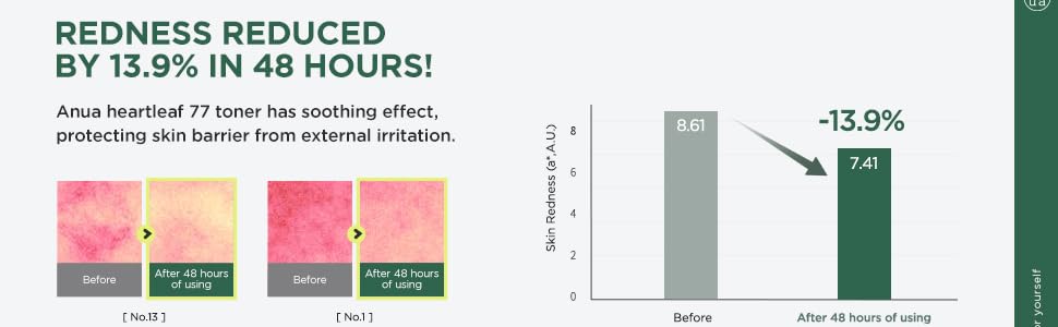 روغن پاک کننده و کنترل منافذ آنوا حاوی عصاره هوتونیا کوردتا 11 روغن پاک کننده و کنترل منافذ آنوا