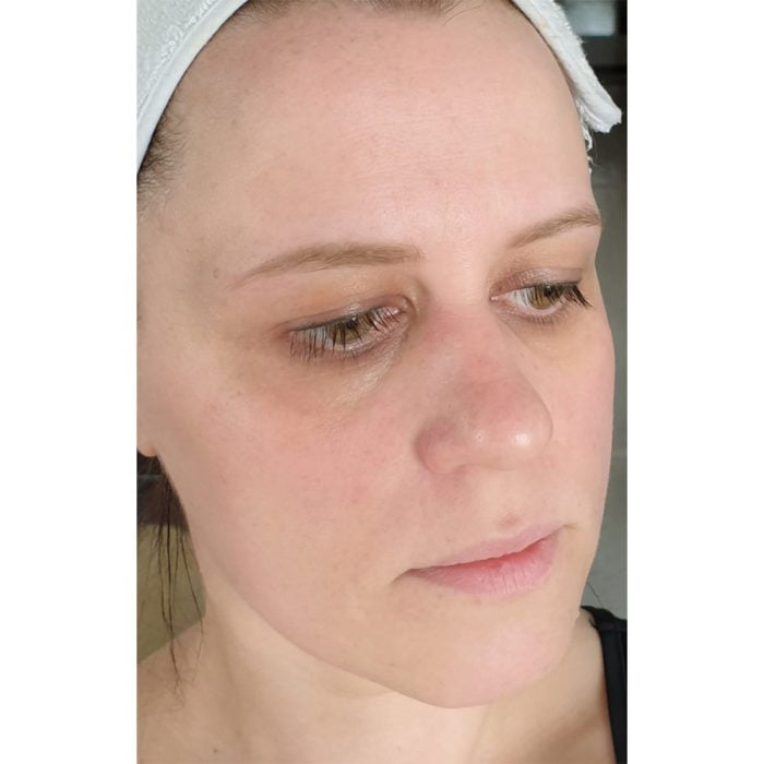 آمپول ضد جوش و ترمیم کننده 30 میل پروپولیس کوزارکس COSRX 7 آمپول ضد جوش و ترمیم کننده 30 میل پروپولیس کوزارکس COSRX - Image 7