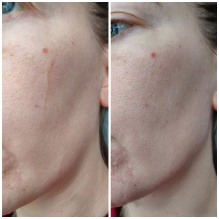 آمپول ضد جوش و ترمیم کننده 30 میل پروپولیس کوزارکس COSRX 4 آمپول ضد جوش و ترمیم کننده 30 میل پروپولیس کوزارکس COSRX - Image 4