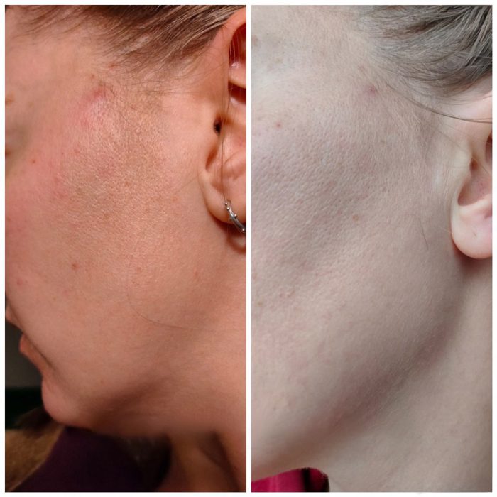 آمپول ضد جوش و ترمیم کننده 30 میل پروپولیس کوزارکس COSRX 3 آمپول ضد جوش و ترمیم کننده 30 میل پروپولیس کوزارکس COSRX - Image 3