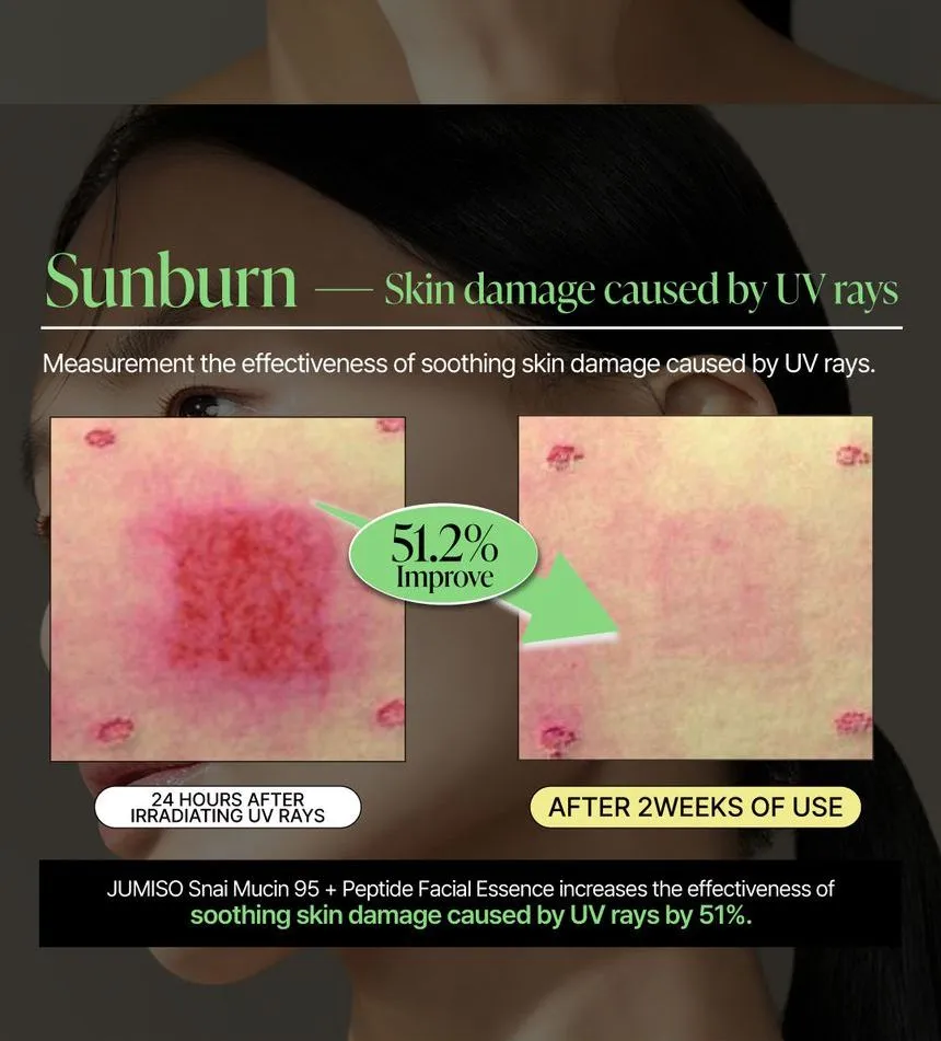 اسنس آبرسان حلزون جومیسو JUMISO Snail Mucin 95% + Peptide 10 اسنس آبرسان حلزون جومیسو JUMISO Snail Mucin 95% + Peptide - Image 10