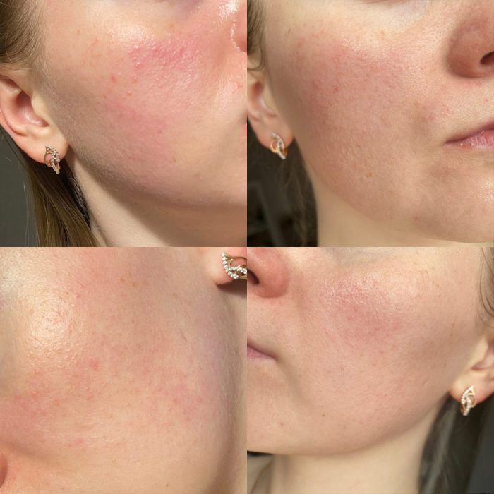 تونر ضد جوش و لایه بردار تیام 180 میلی لیتر 7 تونر ضد جوش و لایه بردار تیام 180 میلی لیتر - Image 7