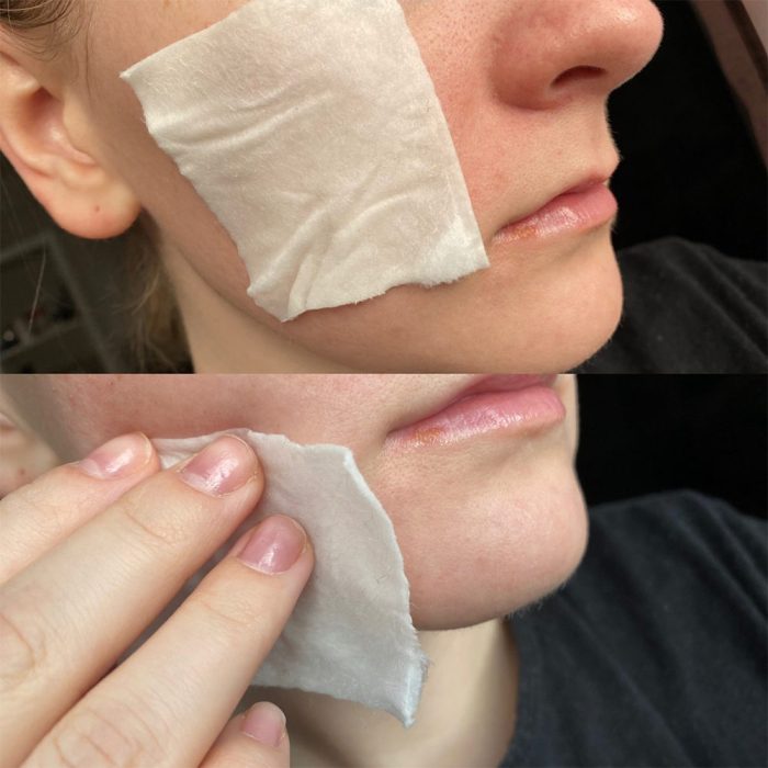 تونر ضد جوش و لایه بردار تیام 180 میلی لیتر 8 تونر ضد جوش و لایه بردار تیام 180 میلی لیتر - Image 8