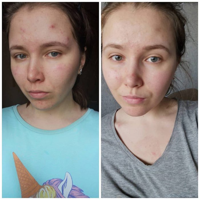 تونر ضد جوش و لایه بردار تیام 180 میلی لیتر 6 تونر ضد جوش و لایه بردار تیام 180 میلی لیتر - Image 6