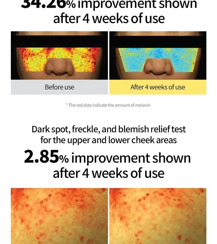 کرم ویتامین سی گودال ضد لک و روشن کننده 50 میلی لیتر 12 کرم ویتامین سی گودال ضد لک و روشن کننده 50 میلی لیتر - Image 12