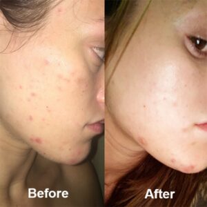 کرم مرطوب کننده و نرم کننده قوی سراوی 340 گرم 9 کرم مرطوب کننده و نرم کننده قوی سراوی