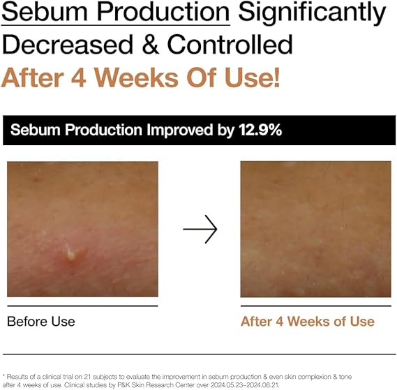 تونر برنج و سراماید آنوا 250 میلی لیتر 4 تونر برنج و سراماید آنوا 250 میلی لیتر - Image 4