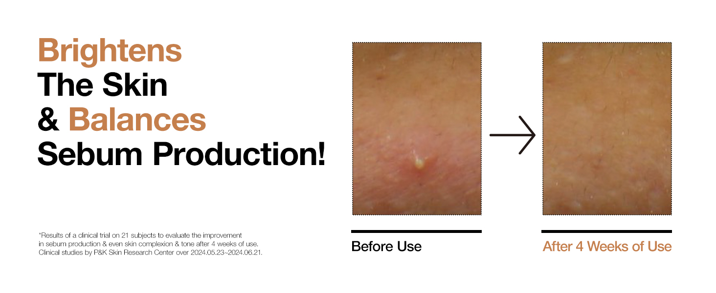 تونر برنج و سراماید آنوا 250 میلی لیتر 11 تونر برنج و سراماید آنوا