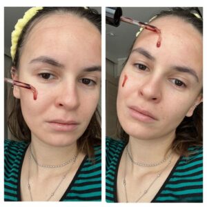 سرم پیلینگ و لایه بردار قوی زامبی بلادی اسکین 1004 16 سرم پیلینگ و لایه بردار قوی زامبی بلادی اسکین 1004