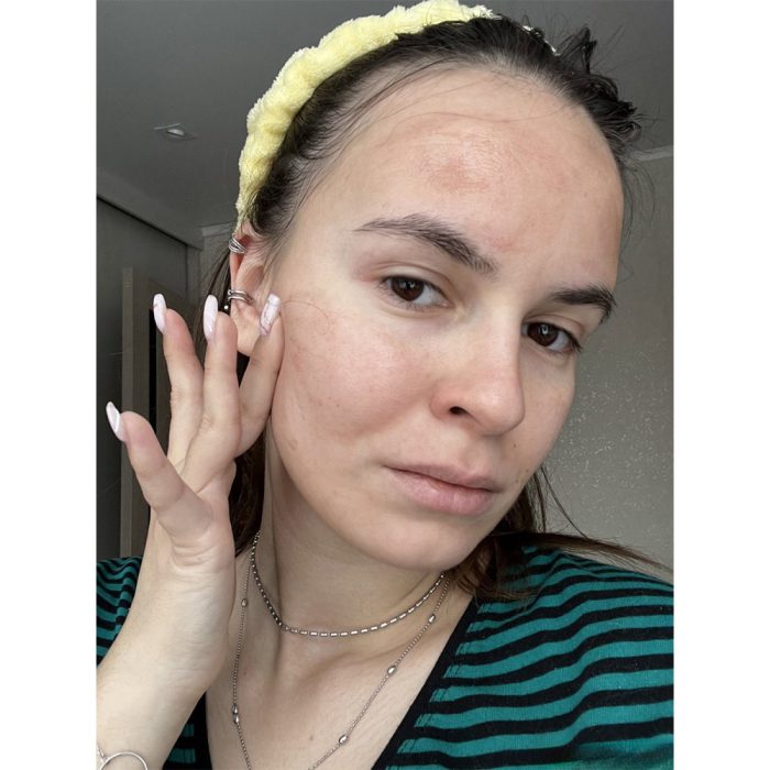 سرم پیلینگ و لایه بردار قوی زامبی بلادی اسکین 1004 8 سرم پیلینگ و لایه بردار قوی زامبی بلادی اسکین 1004 - Image 8