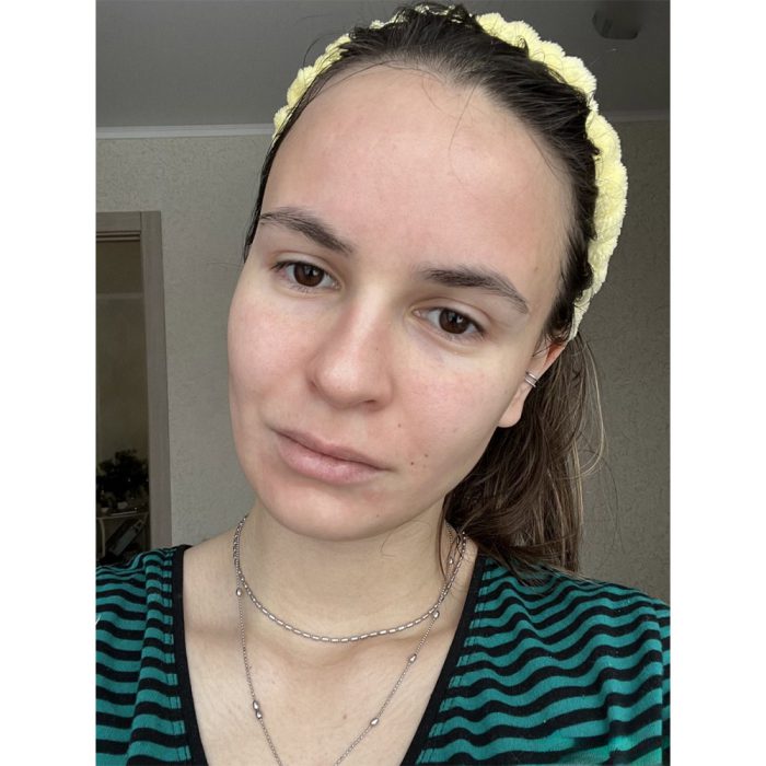 سرم پیلینگ و لایه بردار قوی زامبی بلادی اسکین 1004 7 سرم پیلینگ و لایه بردار قوی زامبی بلادی اسکین 1004 - Image 7