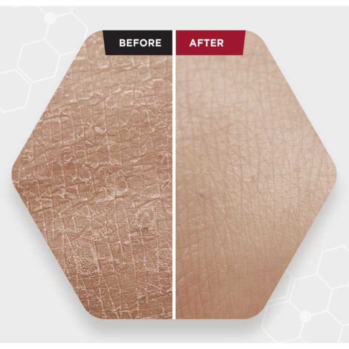 سرم پیلینگ و لایه بردار قوی زامبی بلادی اسکین 1004 5 سرم پیلینگ و لایه بردار قوی زامبی بلادی اسکین 1004