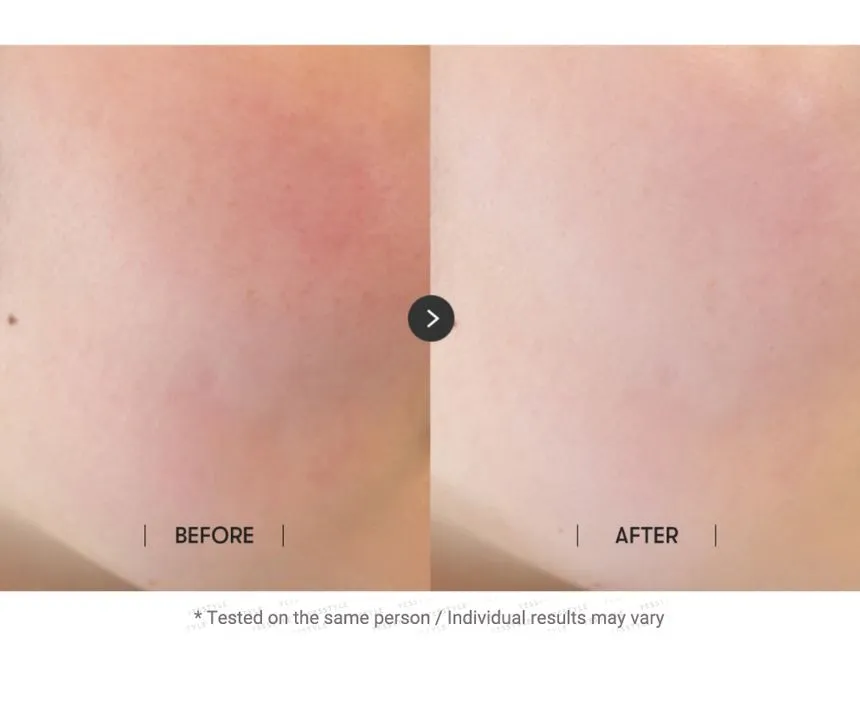 کوشن ضد آفتاب وی تی VT ESSENCE SUN PACT 11g 7 کوشن ضد آفتاب وی تی VT ESSENCE SUN PACT 11g - Image 4