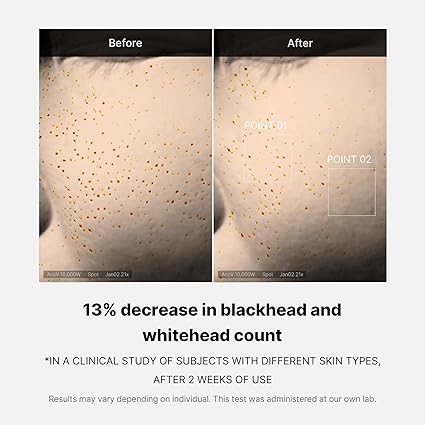 سرم حذف منافذ یک روز مدی کیوب Medicube Zero Pore One-day Serum 5 سرم حذف منافذ یک روز مدی کیوب Medicube Zero Pore One-day Serum - Image 5