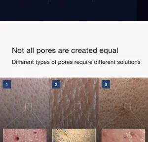 سرم حذف منافذ یک روز مدی کیوب Medicube Zero Pore One-day Serum 14 L g0198340887 002