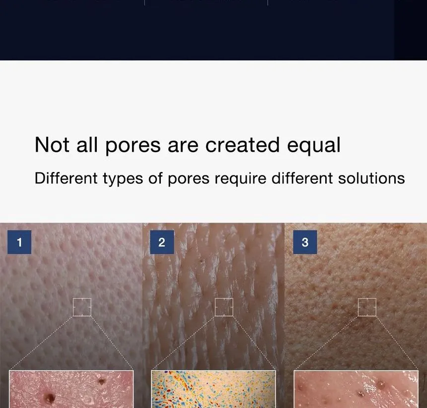 سرم حذف منافذ یک روز مدی کیوب Medicube Zero Pore One-day Serum 7 سرم حذف منافذ یک روز مدی کیوب Medicube Zero Pore One-day Serum - Image 7