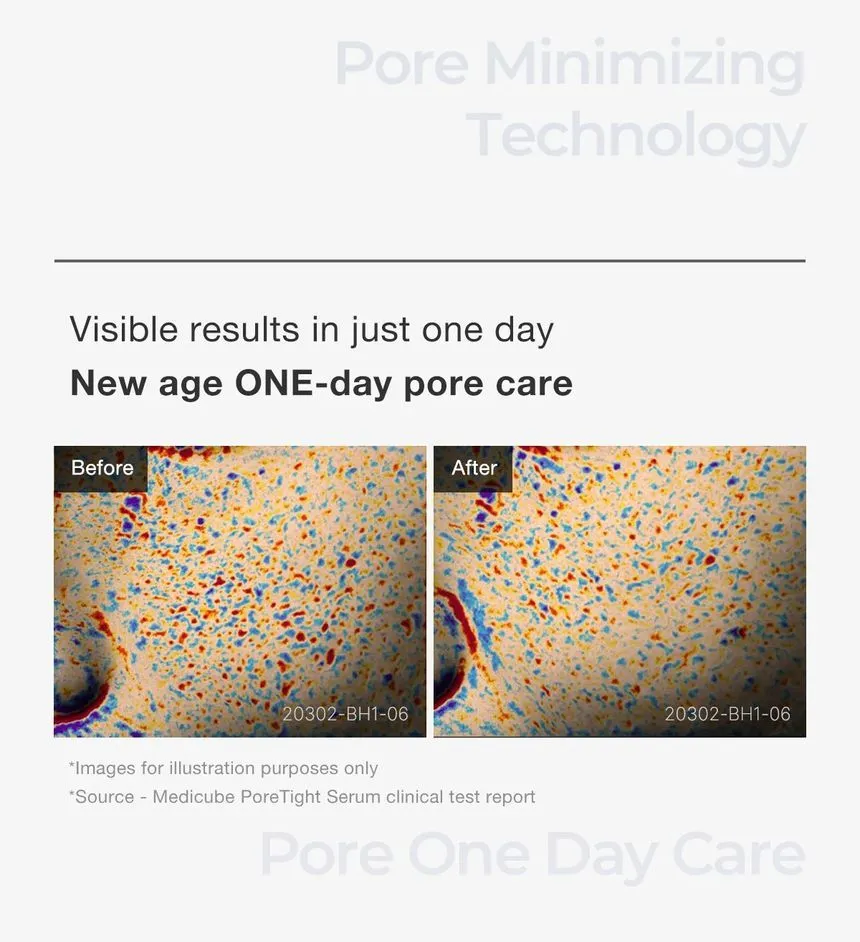 سرم حذف منافذ یک روز مدی کیوب Medicube Zero Pore One-day Serum 8 سرم حذف منافذ یک روز مدی کیوب Medicube Zero Pore One-day Serum - Image 8