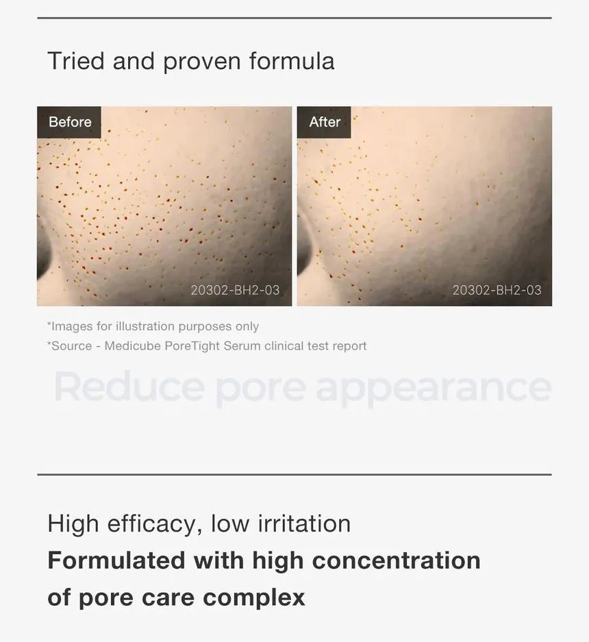 سرم حذف منافذ یک روز مدی کیوب Medicube Zero Pore One-day Serum 9 سرم حذف منافذ یک روز مدی کیوب Medicube Zero Pore One-day Serum - Image 9