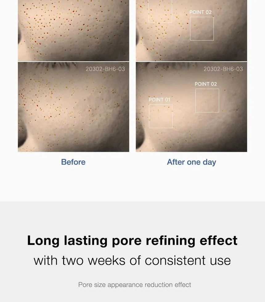 سرم حذف منافذ یک روز مدی کیوب Medicube Zero Pore One-day Serum 10 سرم حذف منافذ یک روز مدی کیوب Medicube Zero Pore One-day Serum - Image 10