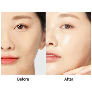 آمپول لیفتینگ آکوا اسنس مدیپیل 50 میلی لیتر 4 19c cbe734e1 d5ac 4f15 ad7b 61a6399d8783