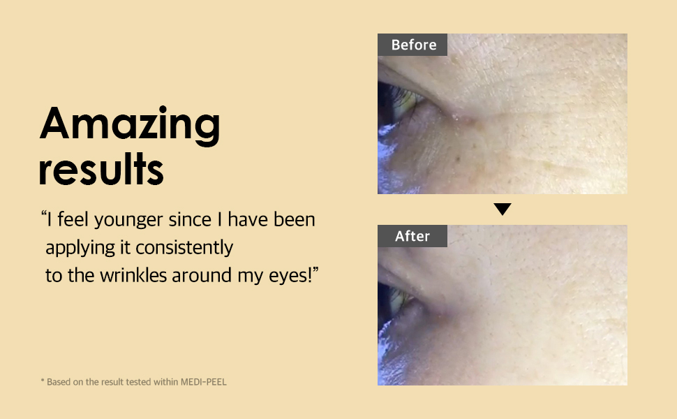 دور چشم حجم دهنده و ضد چروک مدی پیل با 9 پپتاید 5 دور چشم حجم دهنده و ضد چروک مدی پیل با 9 پپتاید - Image 5