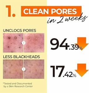 615KtSnpYWL. AC CR0000 SX480 SY360