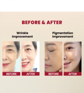 سرم رتینال سئول 1988 کی سکرت 10 سرم رتینال سئول 1988 کیسکرت