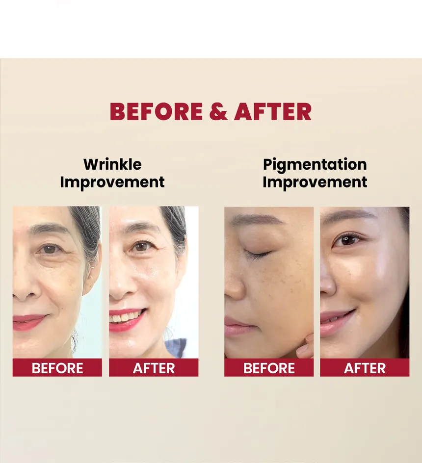 سرم رتینال سئول 1988 کی سکرت 3 سرم رتینال سئول 1988 کیسکرت