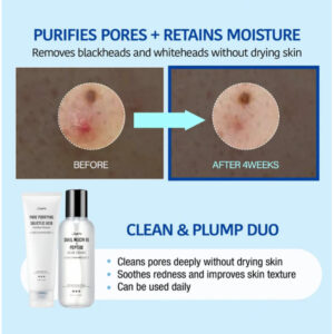 prd side mp 00140437 600x600 1