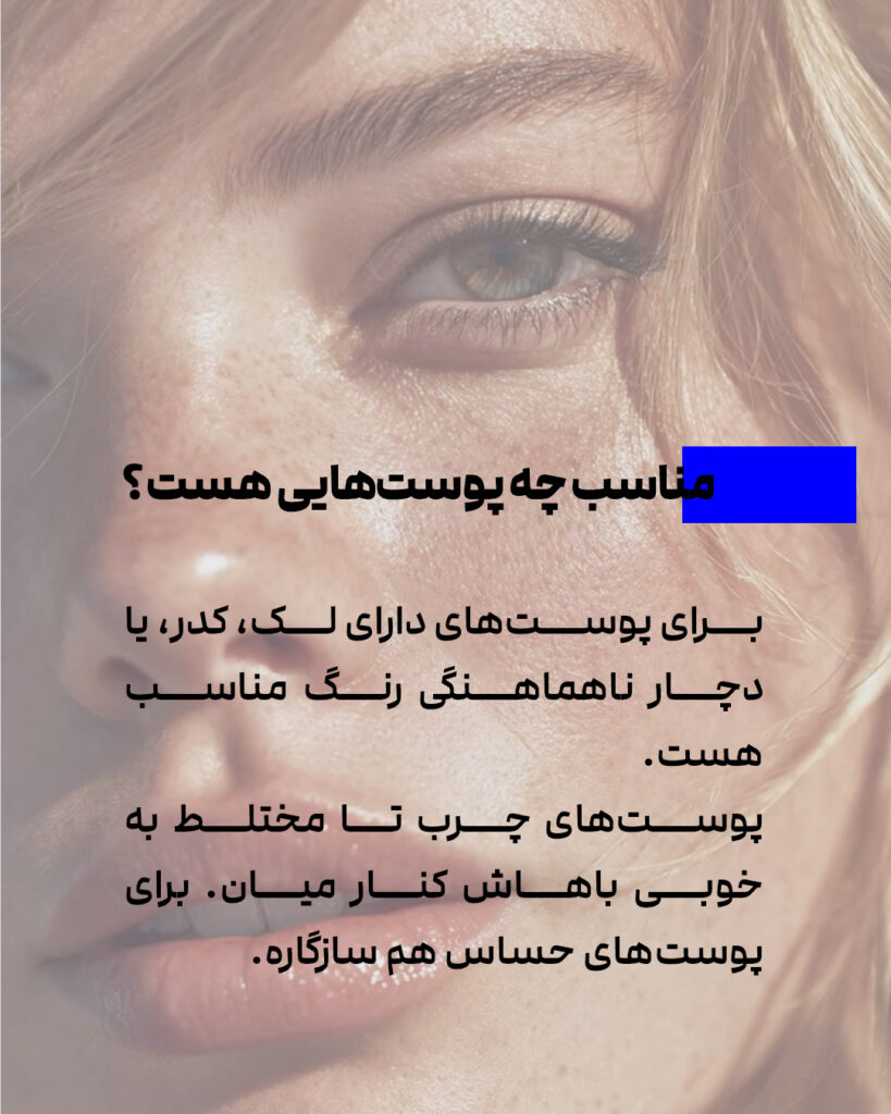 کرمی سبک، با تاثیری سنگین! 3 ca73bba8 9fa8 4565 84dc bbc8bd7aee24