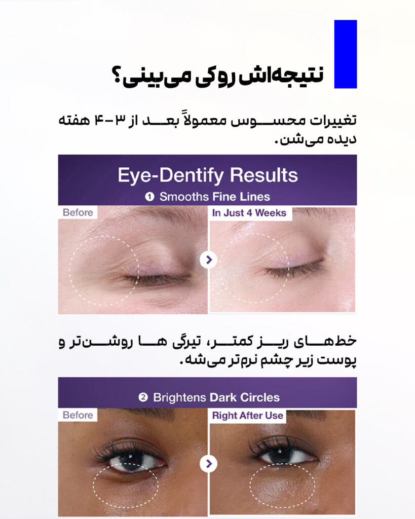 معجزه شماره 9، ناجی دور چشم 3 b97efb17 c2aa 4094 833c ada9abb92cd2