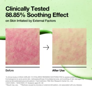 anua us toner 90 ea azelaic 10 hyaluron redness soothing pad 1170826121