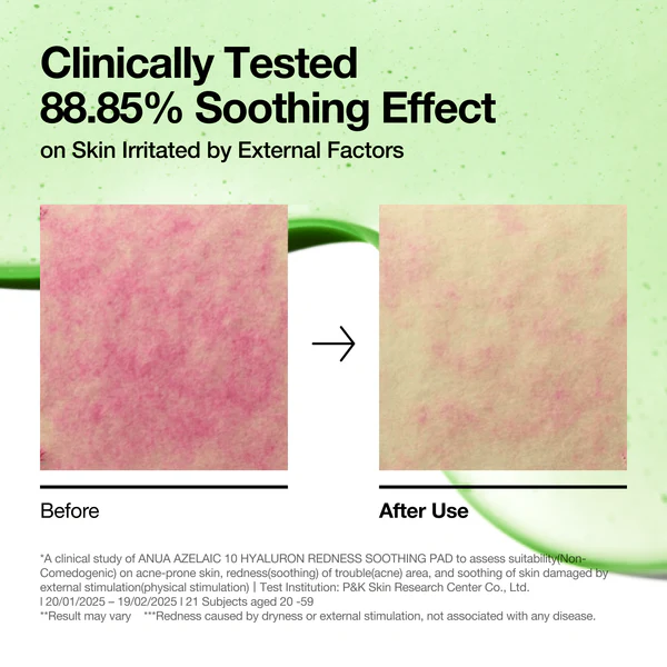 پد آزلائیک اسید آنوا ضدقرمزی Anua Azelaic 10 Hyaluron Redness Soothing pad 4 پد آزلائیک اسید آنوا ضدقرمزی Anua Azelaic 10 Hyaluron Redness Soothing pad - Image 4